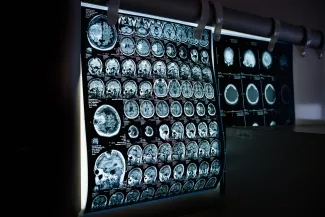 Overlooking Diagnostic Errors The Grave Potential Consequences for Patient Safety Overlooking Diagnostic Errors The Grave Potential Consequences for Patient Safety